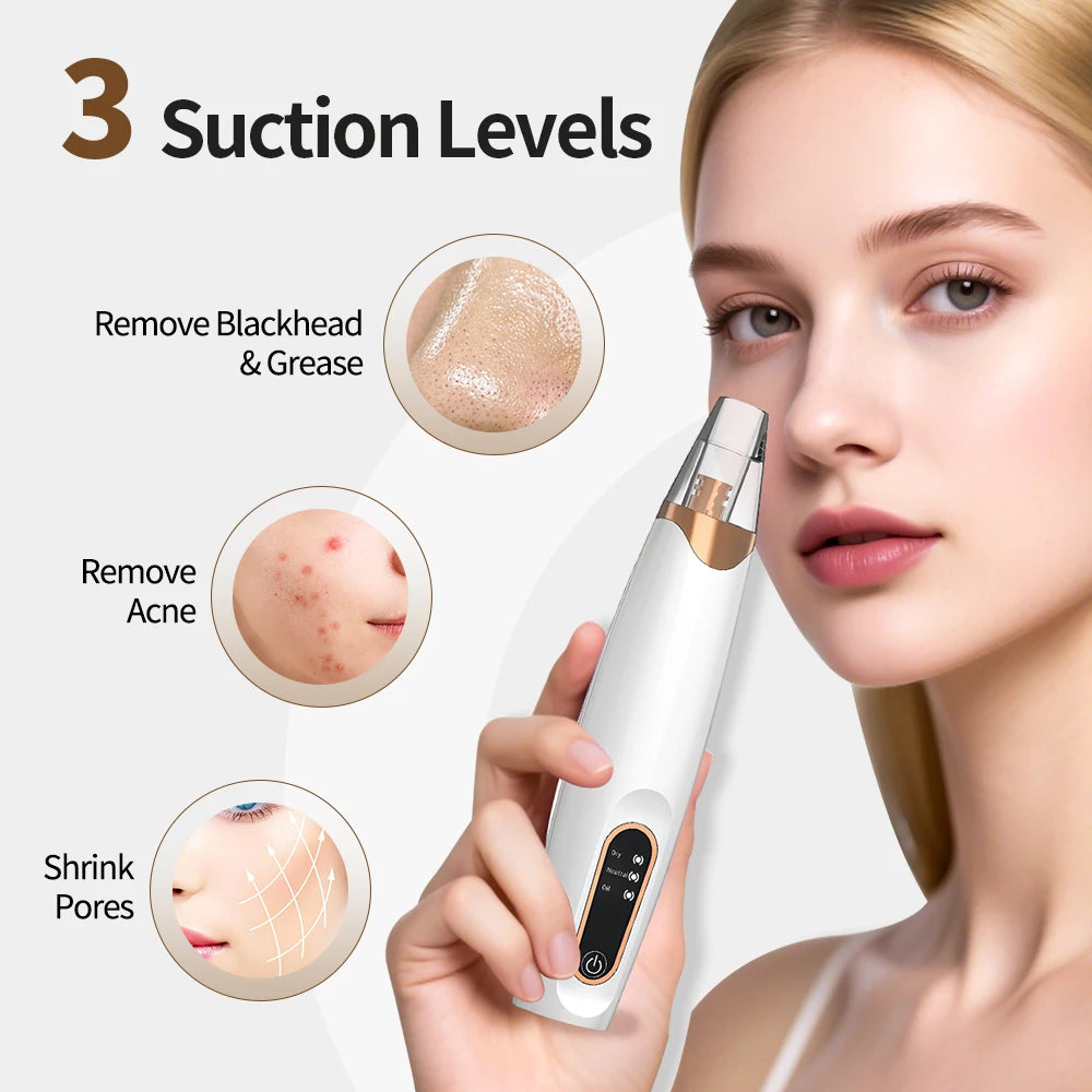 Electric Blackhead Remover Beauty Facial Cleaner Black Point Vacuum Suction Black Head Dots Remover Extractor Skin Care Tools